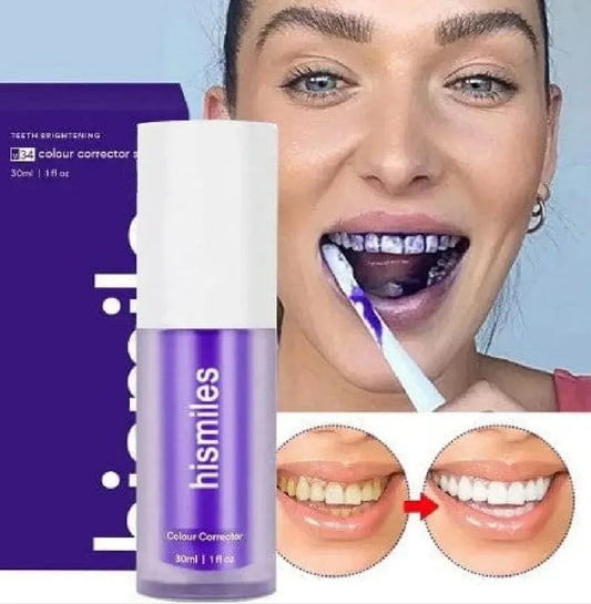 Hismile v34 Instant Teeth Whitening