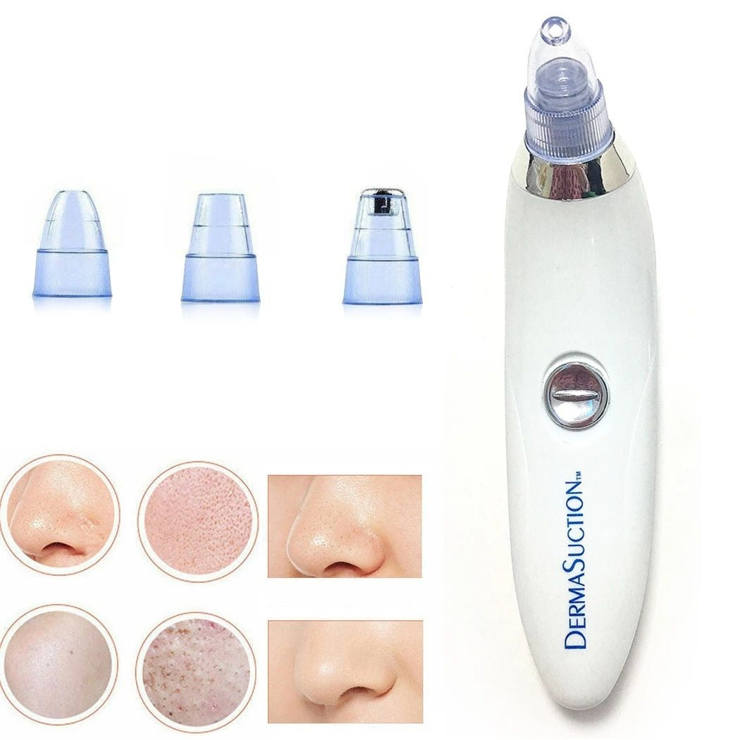 4 in 1 Black Head Remover